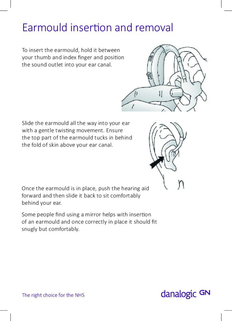How to remove and insert an earmould
